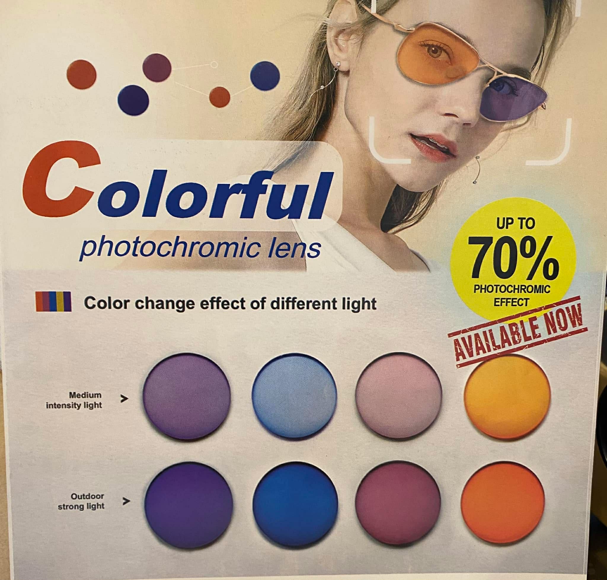 Lens upgrade service